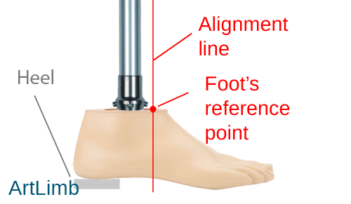 Prosthetic Socket Alignment: Front to Back